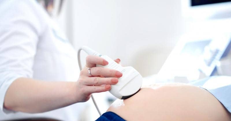 Apakah Ibu Hamil Perlu USG sebelum Berangkat Mudik?