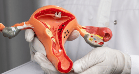 Kesehatan Reproduksi perempuan .png