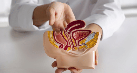 Memahami Tentang Vasektomi,.png