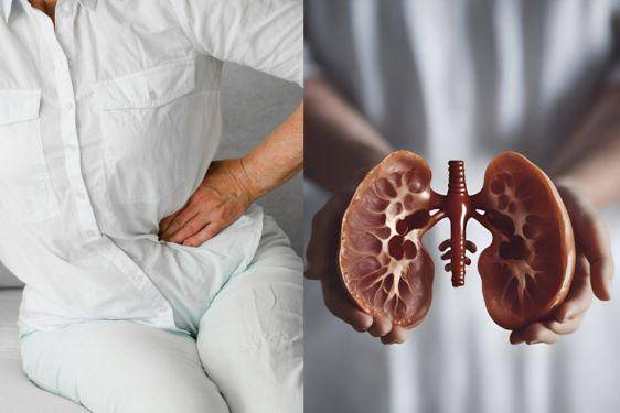 Benarkah Asam Urat Gejala Gagal Ginjal? Cek Faktanya di Sini!