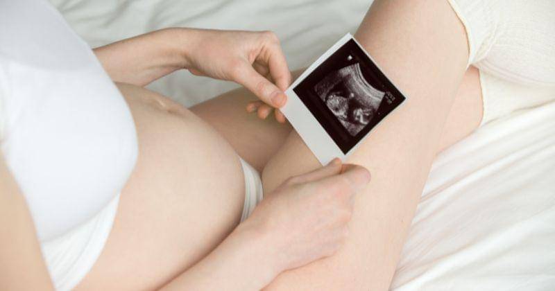 Bagaimana alpukat dapat mengurangi risiko alergi makanan pada bayi.jpg