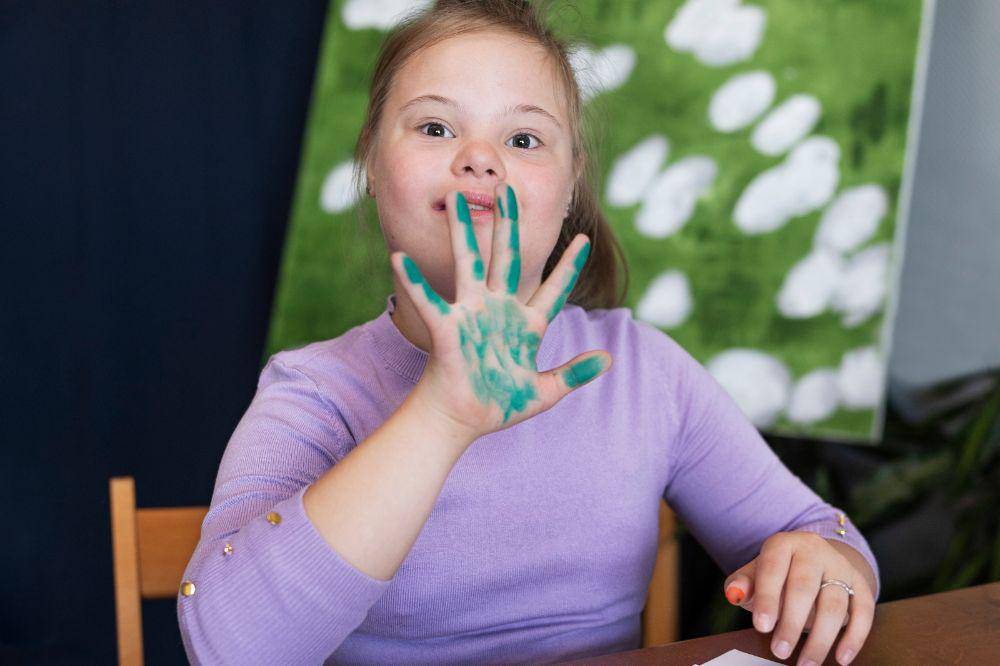 perkembangan motorik anak dengan down syndrome