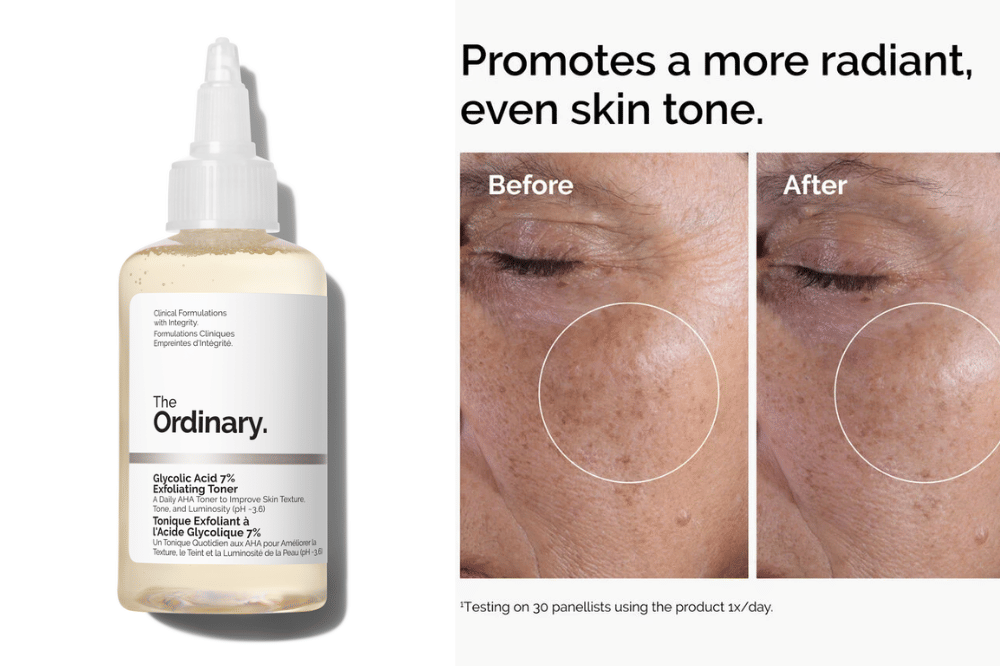 toner penyeimbang kulit