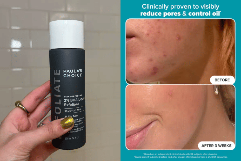 toner penyeimbang kulit