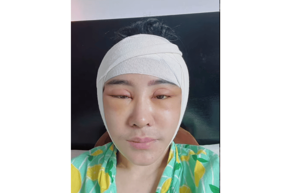 Uut Permatasari Jalani Operasi di Korea (4).png