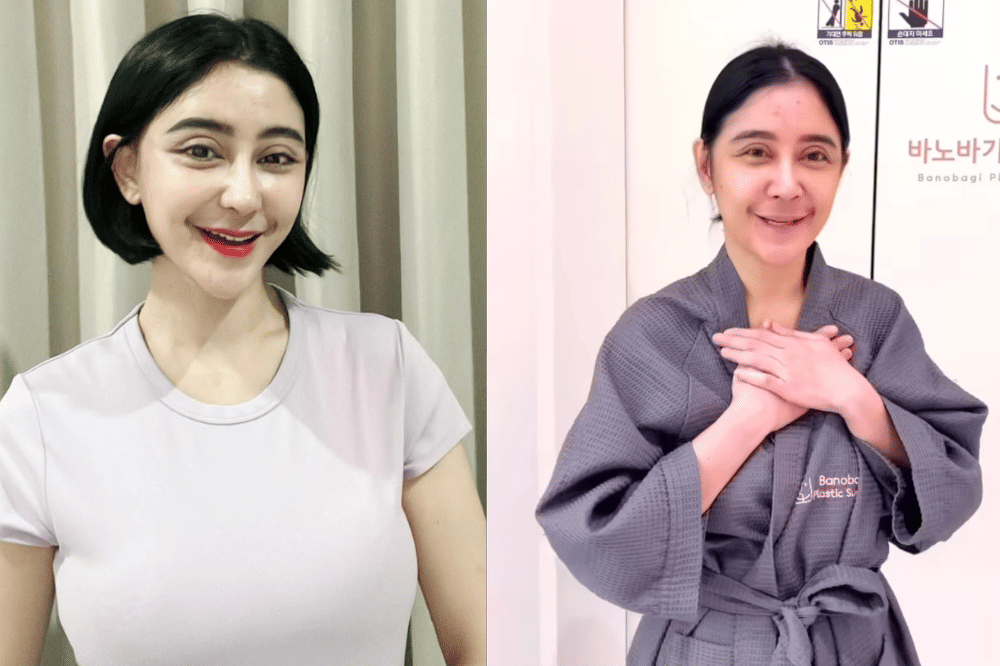 Uut Permatasari Jalani Operasi di Korea.png