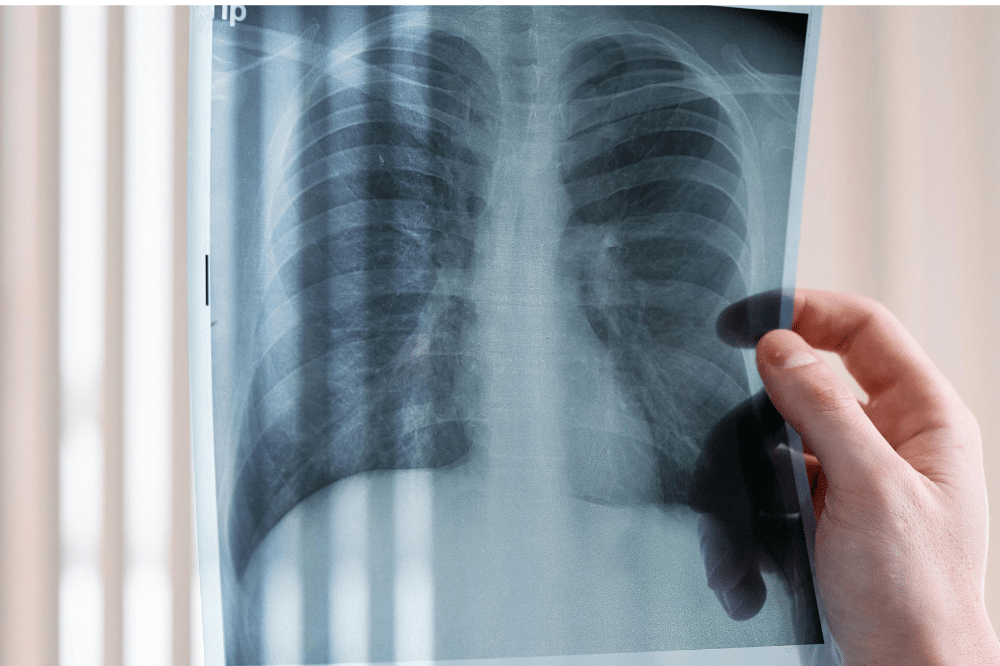 6 Bahaya Vape dan Rokok bagi Kesehatan 2.png