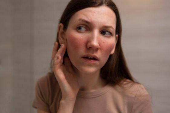 9 Fakta Penyakit Lupus, Termasuk dalam Penyakit Autoimun 4.jpg