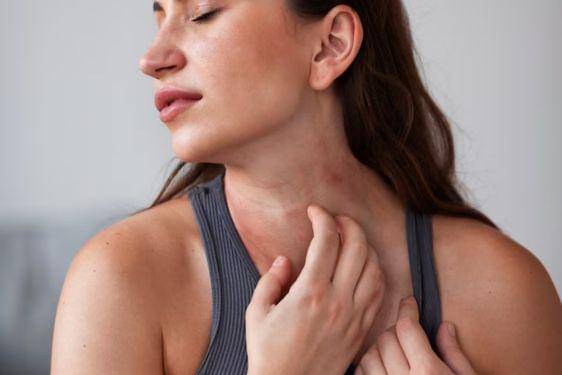 9 Fakta Penyakit Lupus, Termasuk dalam Penyakit Autoimun 2.jpg