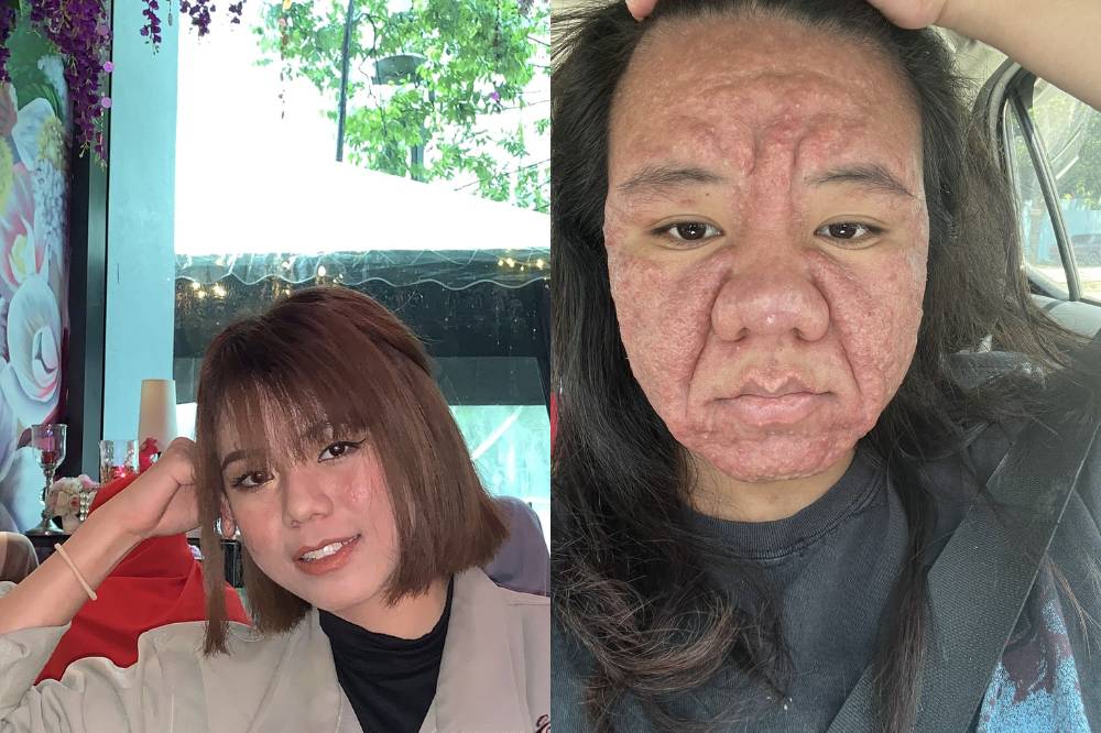 Berubah drastis saat hamil, bumil ini viral usai curhat rasa insecure.png