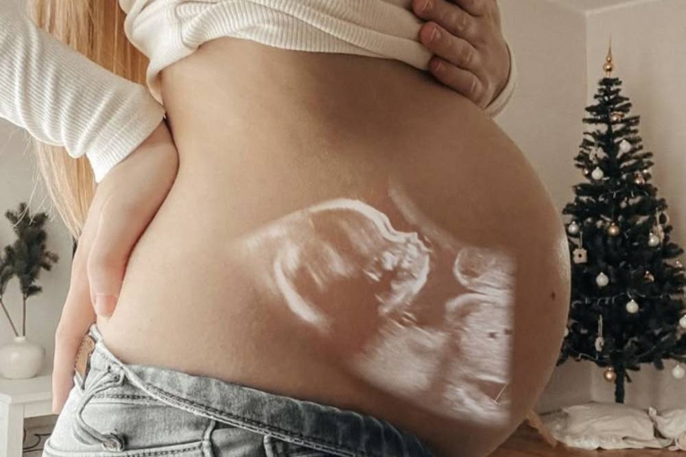 Ilustrasi bayi dalam kandungan.png