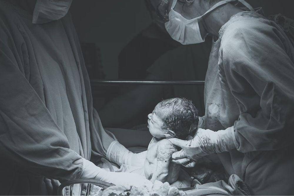 Idap Tumor Langka, Bayi LynLee ‘Lahir Dua Kali’ dari Rahim Ibunya (2).jpg