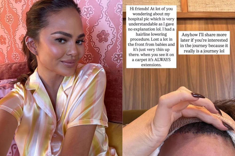 Chrissy Teigen (1).png