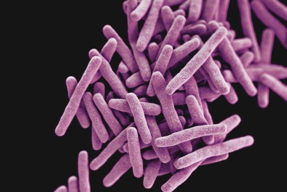 Apa Penyebab Penyakit TBC? Hindari Kebiasaan Ini