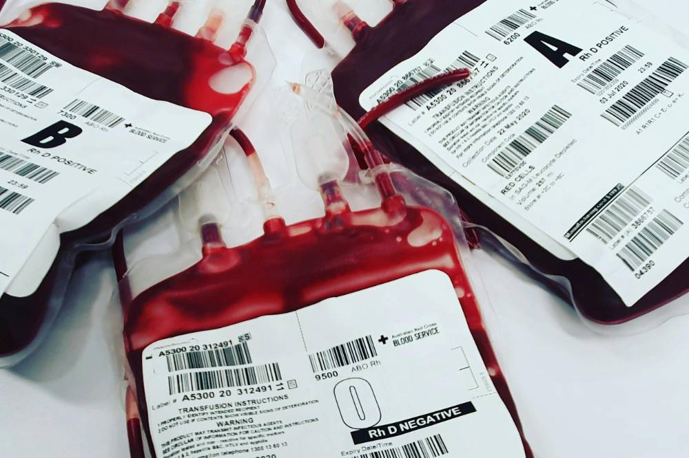 12 Manfaat Donor Darah bagi Perempuan dan Laki-Laki, Baik untuk Kesehatan!.png