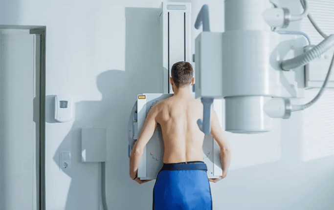 Apa Itu TBC? Ini Penjelasan Lengkapnya