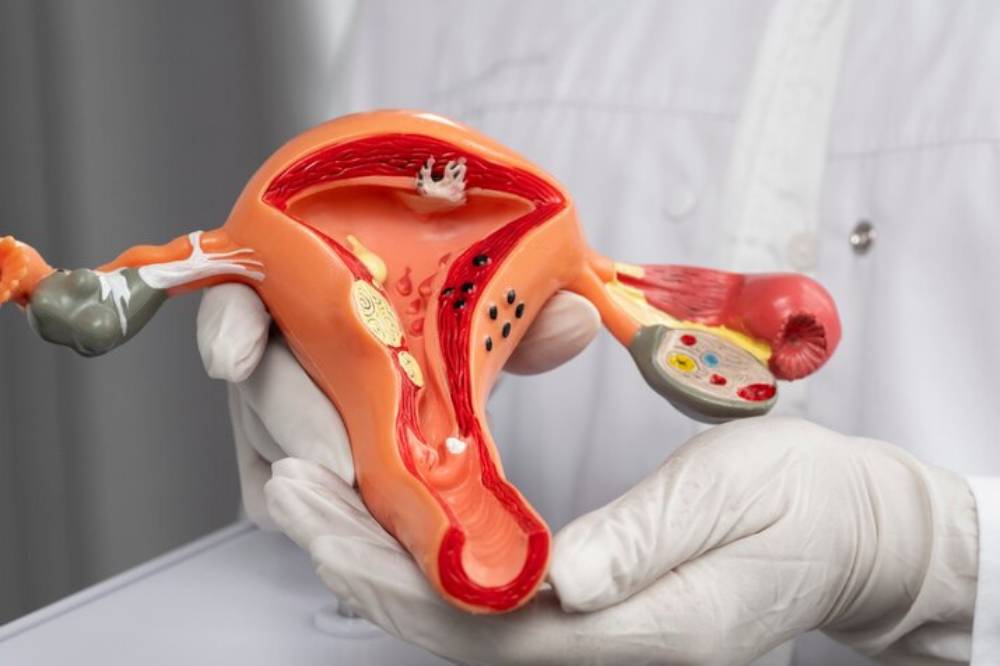 Ruptur uteri.png
