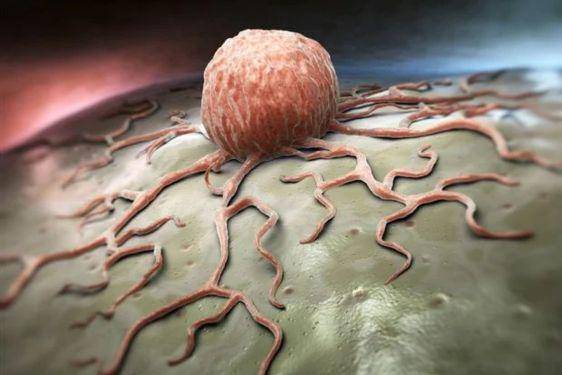 Apa Itu Tumor_ Kenali Ciri, Penyebab dan Bentuknya 5.jpg