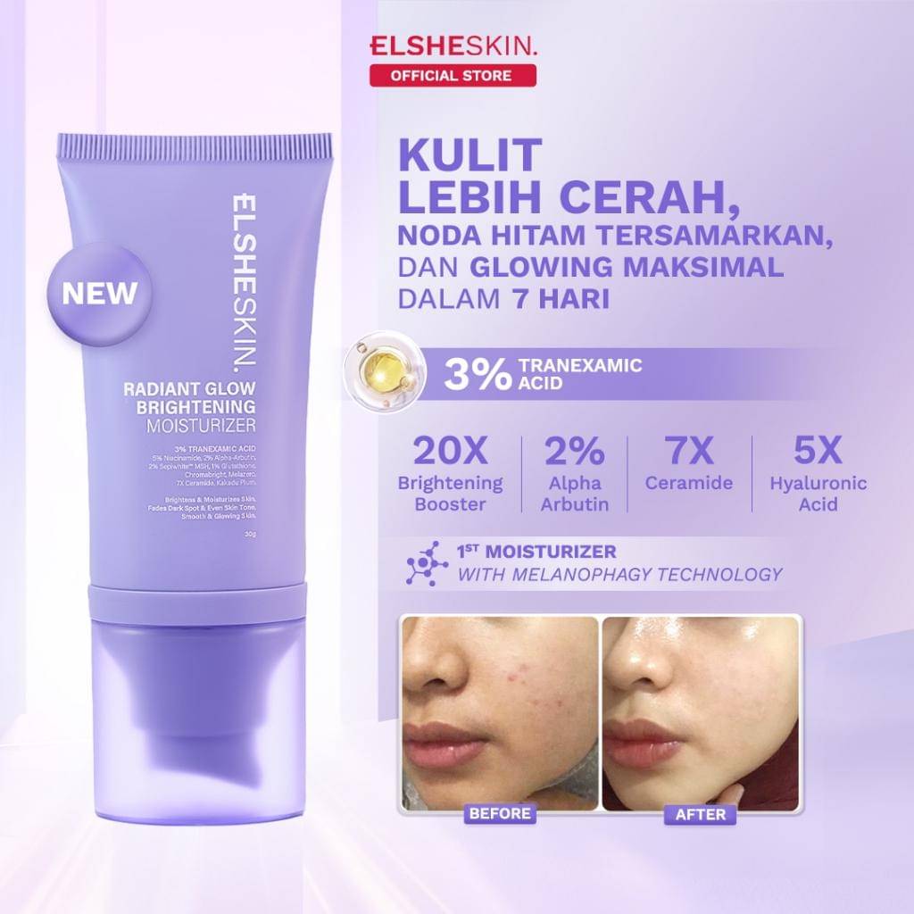 Elsheskin Radiant Glow Moisturizer (shopee.co.id/ElsheSkin Official Shop)
