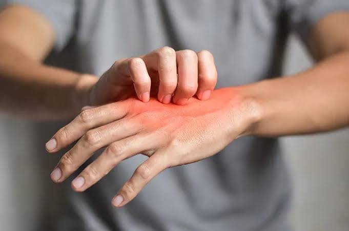 Apa Itu Penyakit Lyme yang Diderita Justin Timberlake?