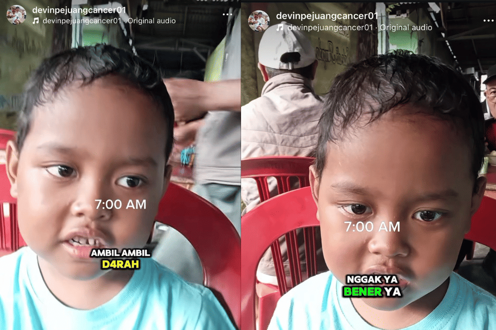 Video Instagram Devin update perkembangan kemonya