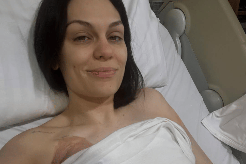 Perjalanan Jessie J Melawan Kanker Payudara 3.png