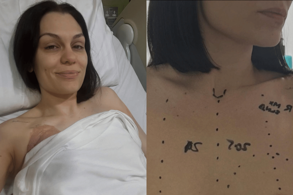 Perjalanan Jessie J Melawan Kanker Payudara 1.png