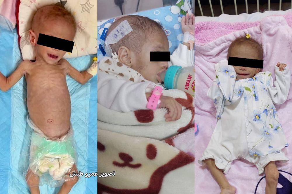 anak gaza meninggal