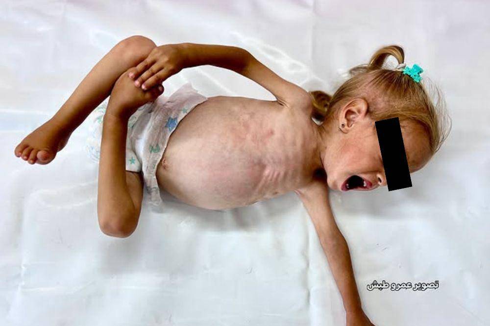 anak gaza meninggal
