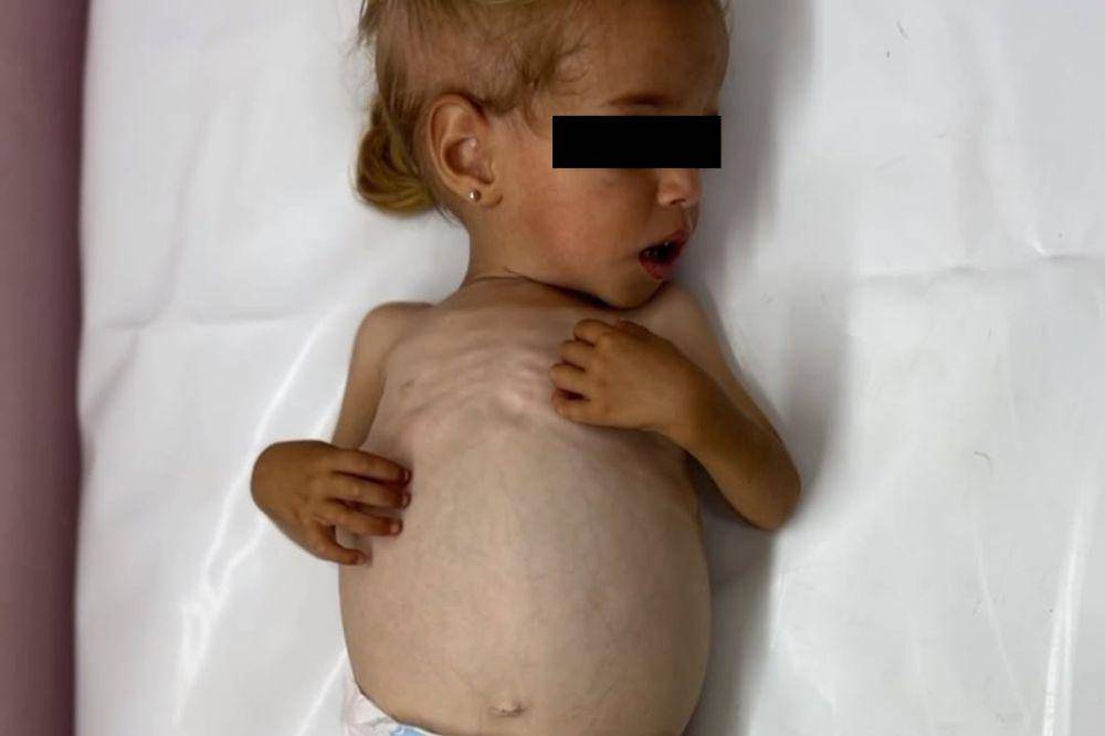 anak gaza meninggal