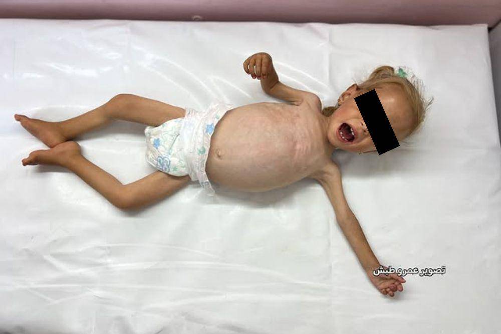 anak gaza meninggal