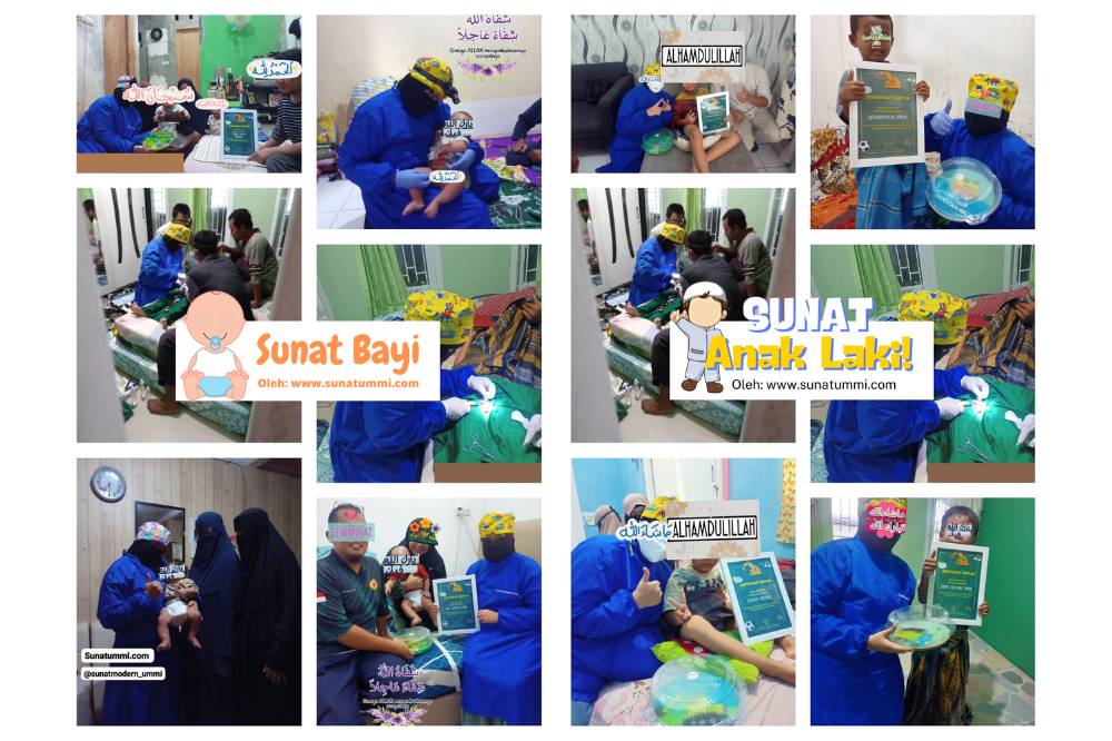 Sunat Ummi