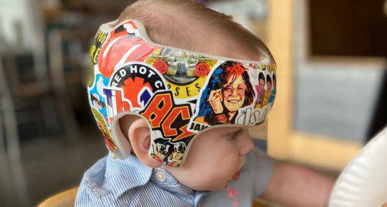 Etsy+Cranial Helmet