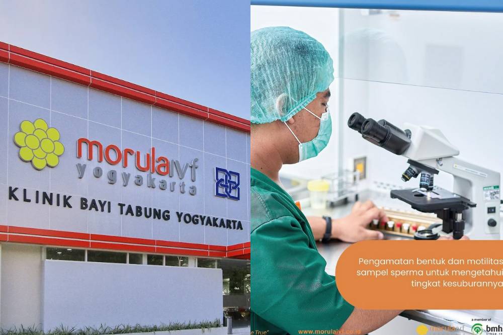 klinik cek sperma jogja