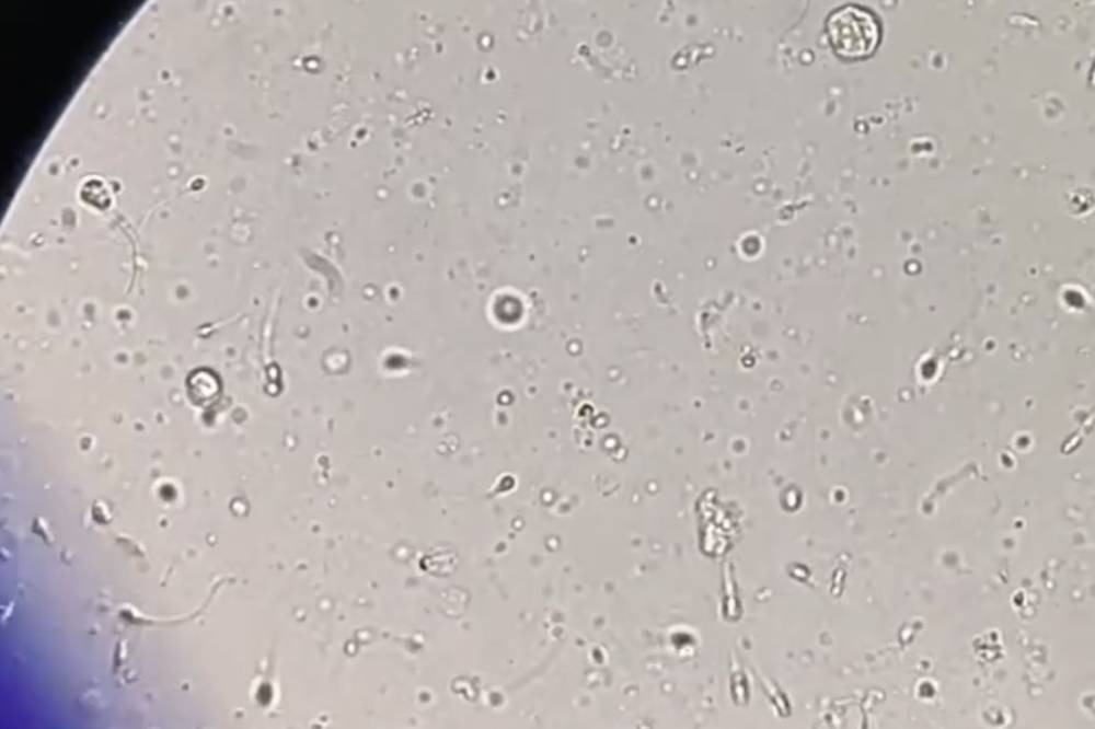 tempat analisis sperma makassar