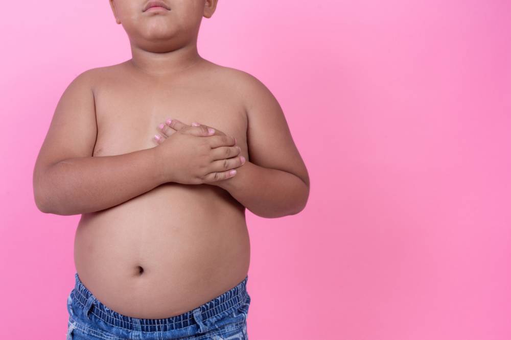 Anak dengan berat badan berlebih