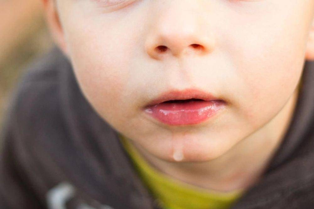 anak 1,5 tahun masih ngeces