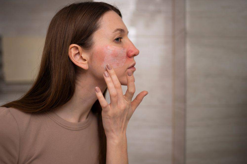 Waspada! Ini Tanda Alergi Parfum pada Kulit yang Jarang Disadari