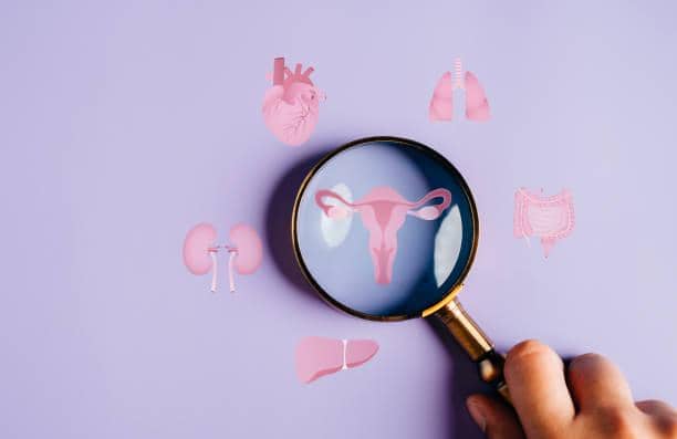 Kenapa Penyebutan PCOS Dianggap Salah Kaprah, Ini Alasannya
