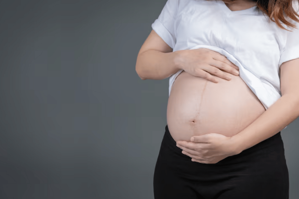 Nita Vior Ngaku Tak Cukur Bulu Perut Saat Hamil 5.png