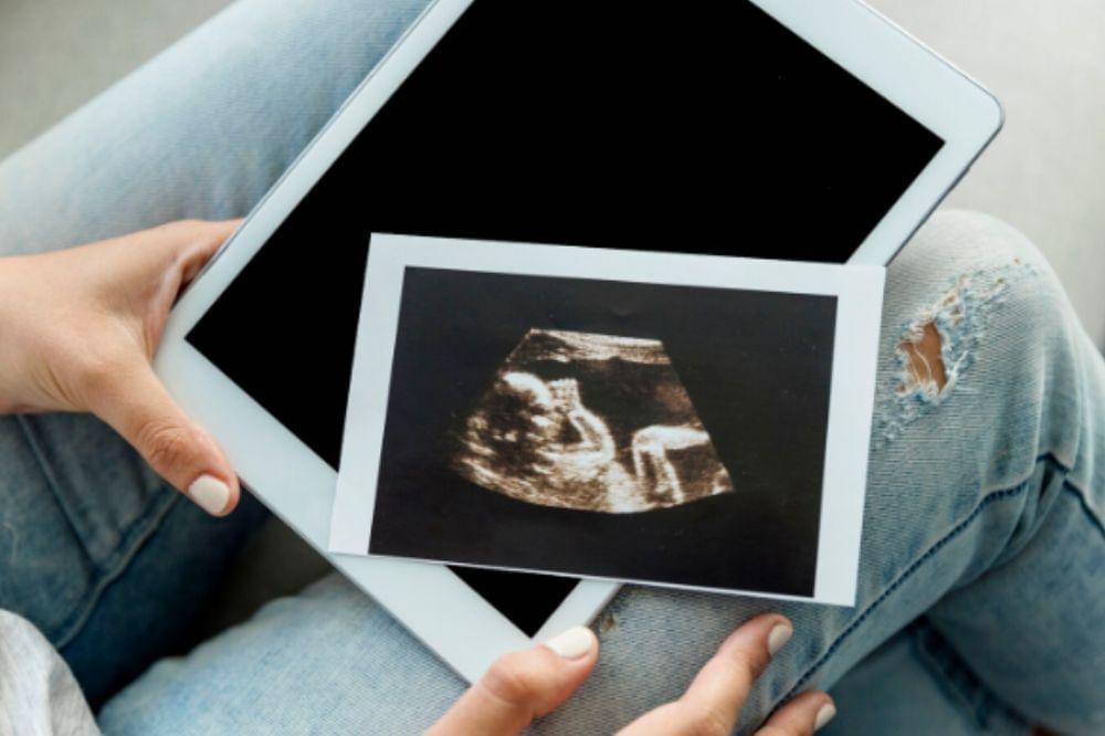 Waspada! Ini 5 Tanda Keguguran Sebelum Melahirkan