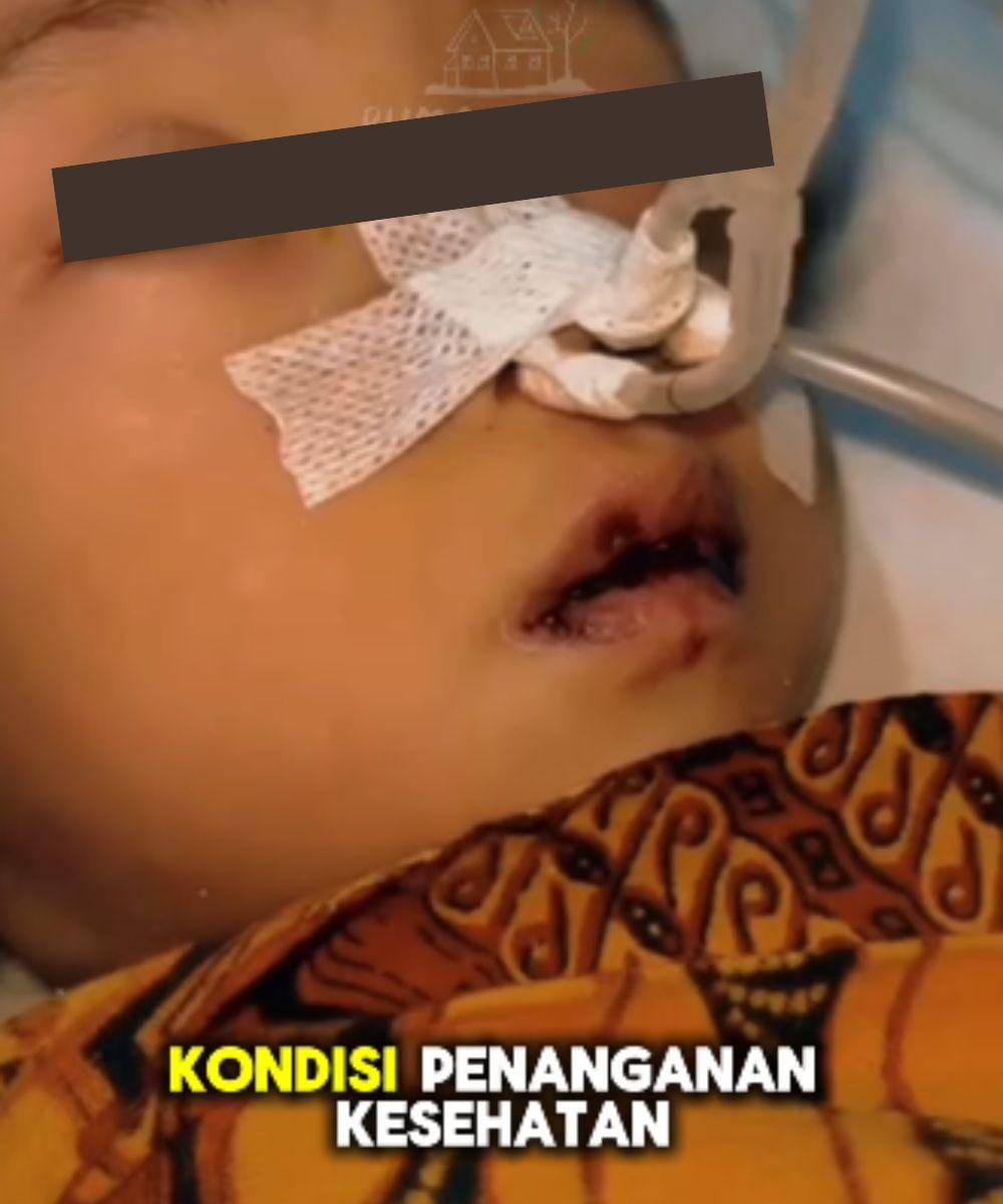 bocah anak 4 tahun meninggal karena cacing