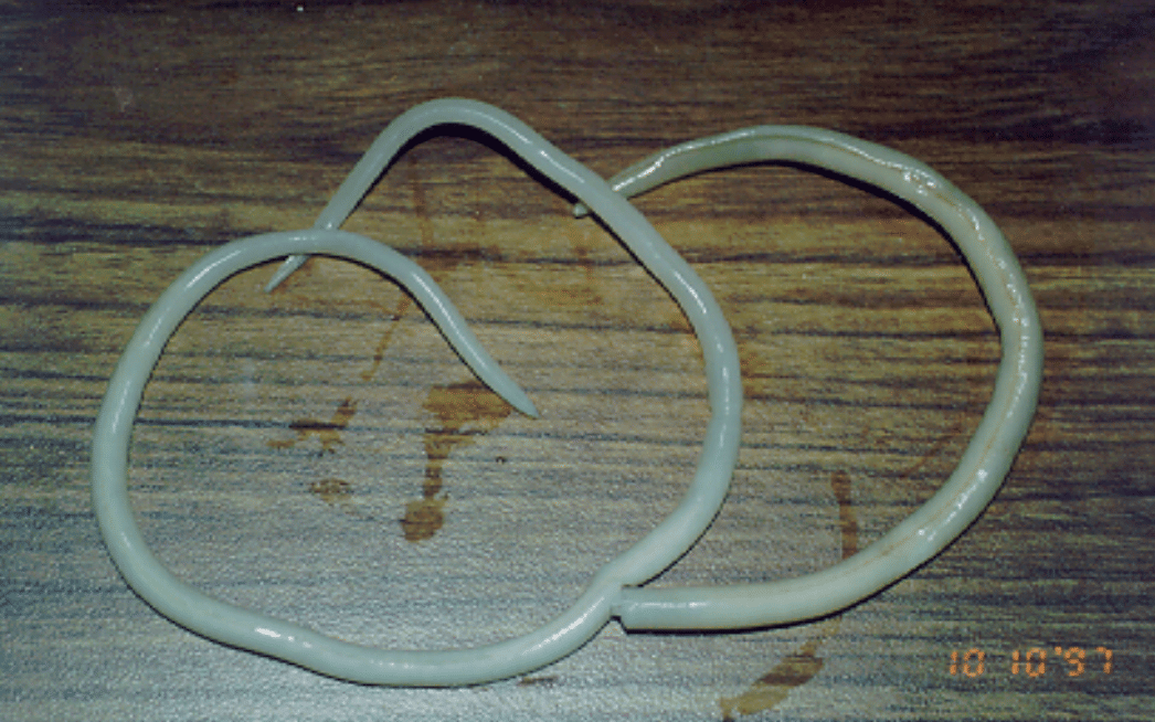 Cacing parasit Ascaris lumbricoides dewasa. (commons.wikimedia.org/SuSanA Secretariat)