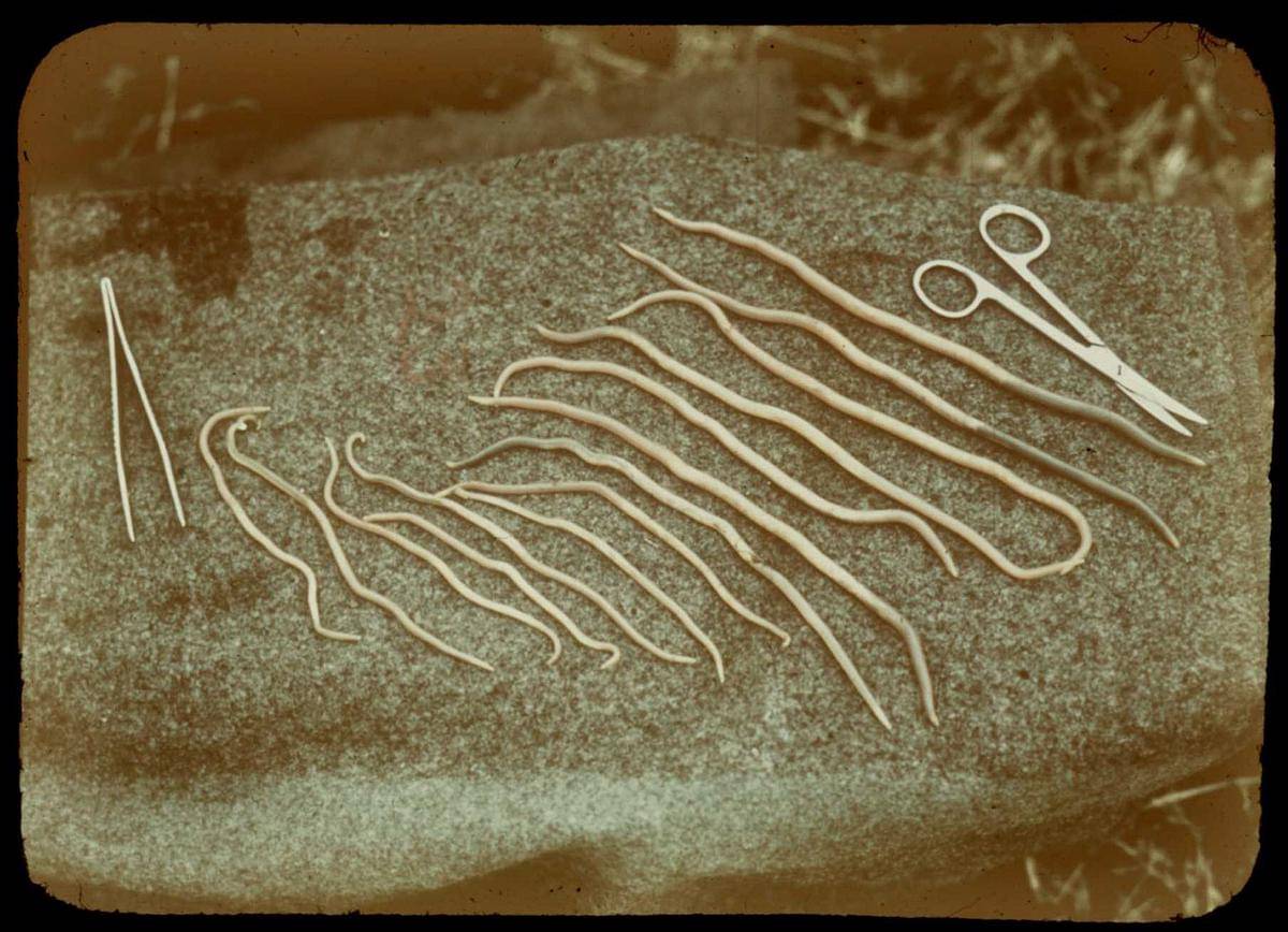 Ilustrasi cacing Ascaris lumbricoides (commons.wikimedia.org/National Museum of Health and Medicine)