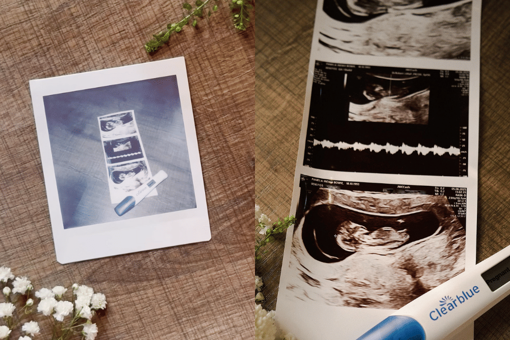 Fakta Kehamilan Kedua Pamela Bowie 1.png