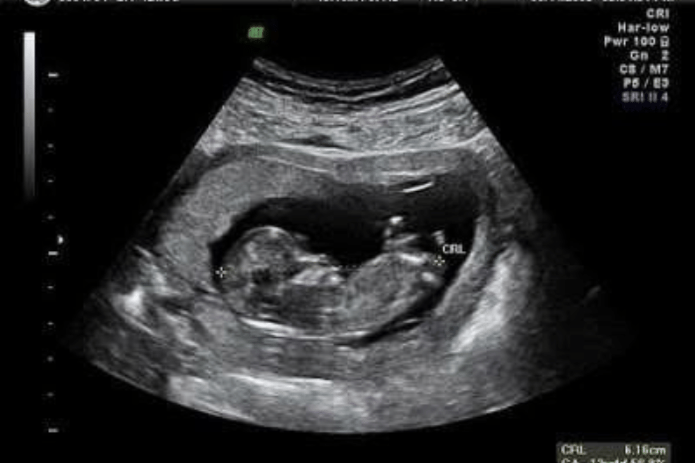 Pinterest.com/ririnekawati130