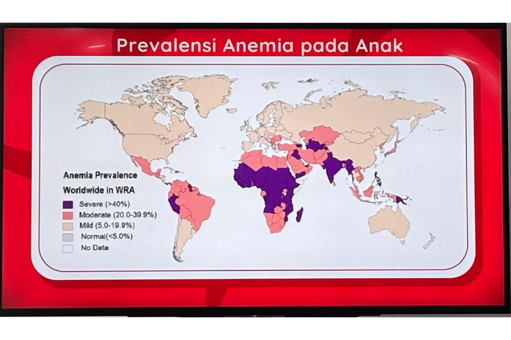 Cegah Anemia Defisiensi Zat Besi pada Anak, Waspadai Penyebabnya!