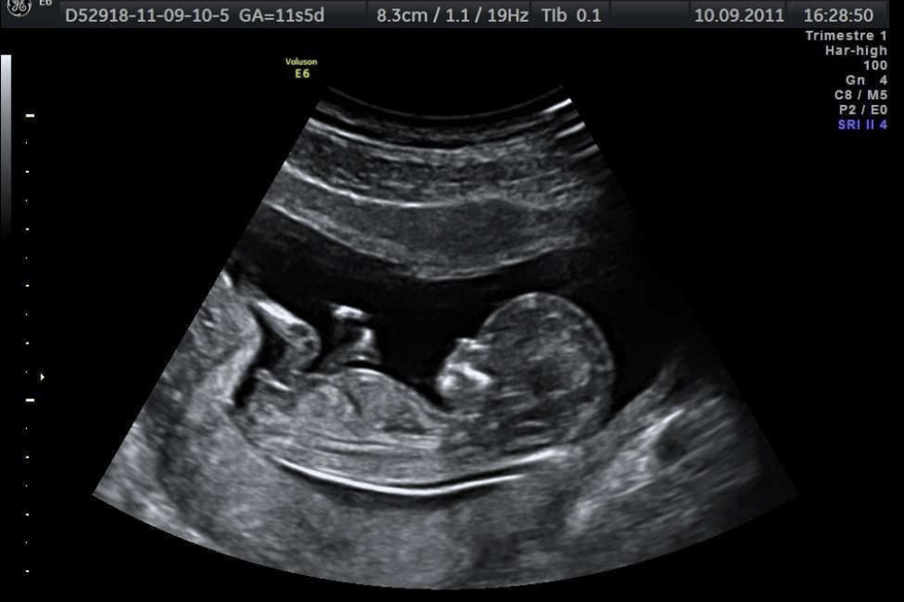 Pinterest.com/jade97574