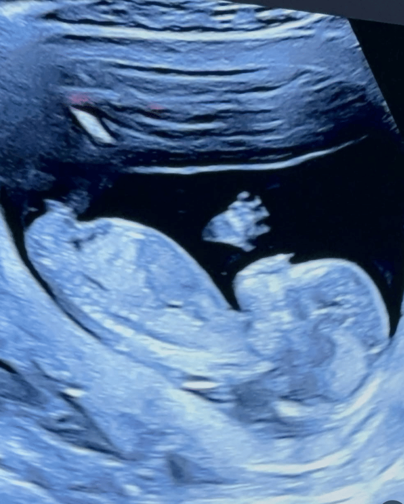 babyvior (2).png