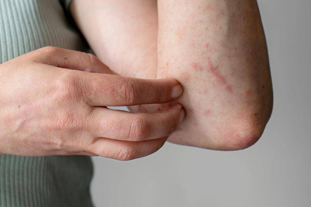 Kulit Bisa Ungkap Kondisi Kesehatan Tubuh, Ini Tandanya